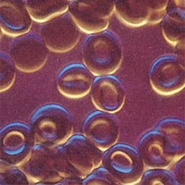Una porción del tejido sanguíneo, en la que se observan particularmente glóbulos rojos